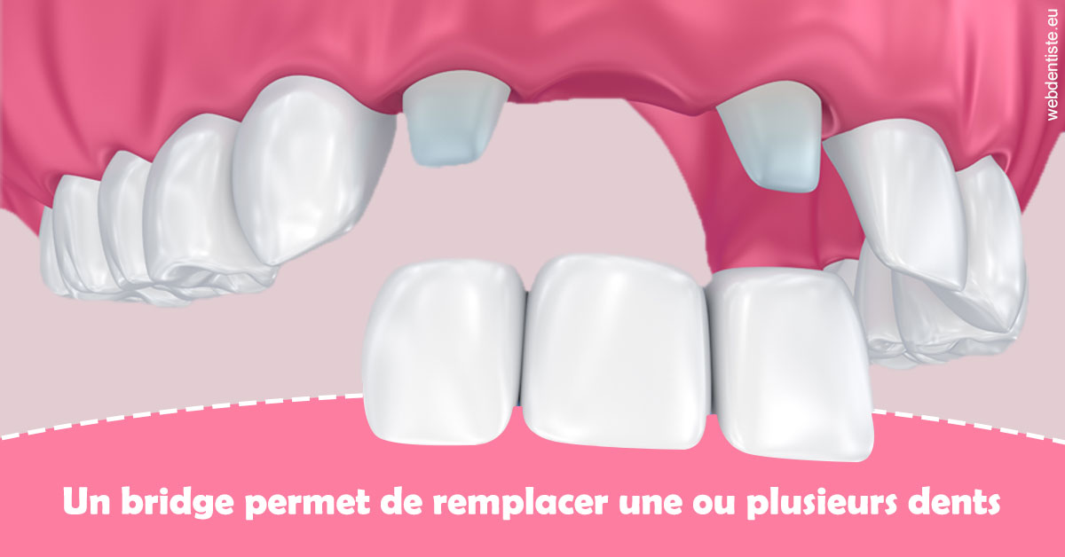 https://dr-janvier-guillemette.chirurgiens-dentistes.fr/Bridge remplacer dents 2
