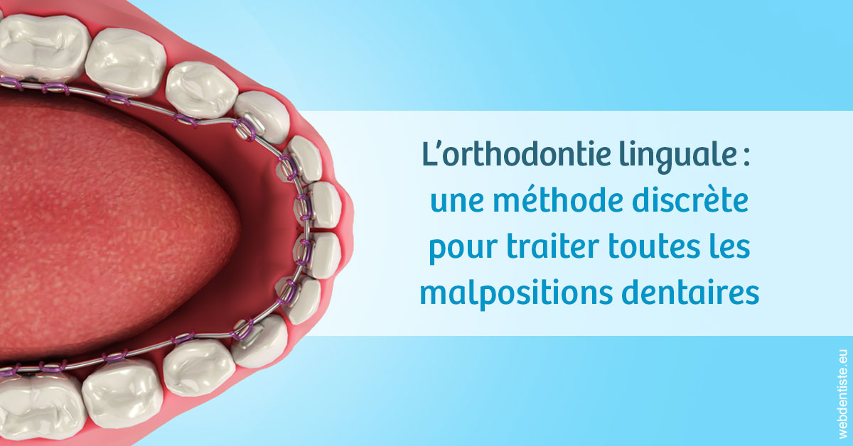 https://dr-janvier-guillemette.chirurgiens-dentistes.fr/L'orthodontie linguale 1