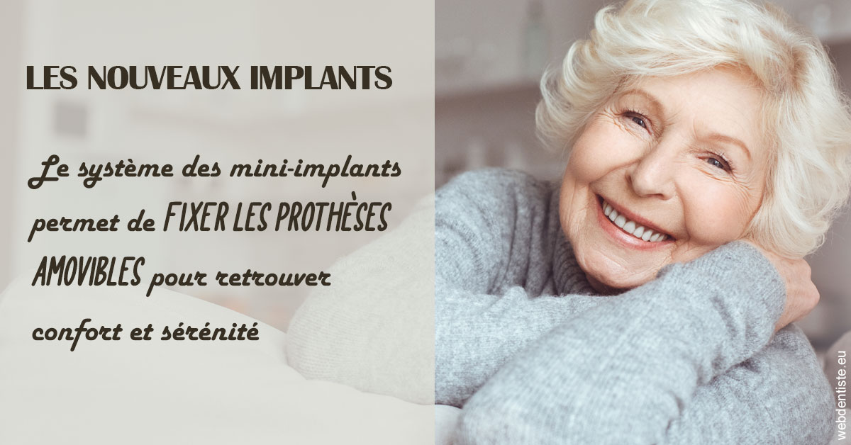 https://dr-janvier-guillemette.chirurgiens-dentistes.fr/Les nouveaux implants 1