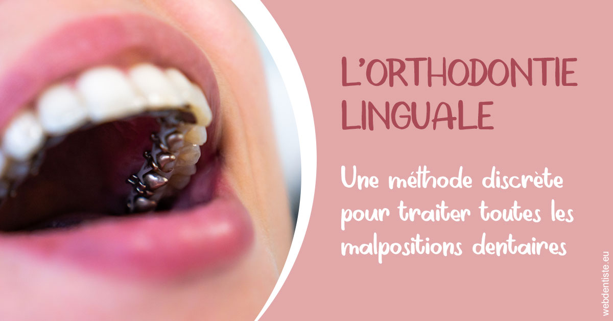 https://dr-janvier-guillemette.chirurgiens-dentistes.fr/L'orthodontie linguale 2
