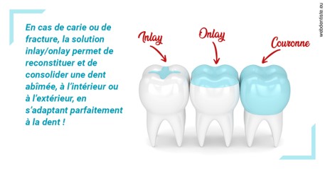 https://dr-janvier-guillemette.chirurgiens-dentistes.fr/L'INLAY ou l'ONLAY