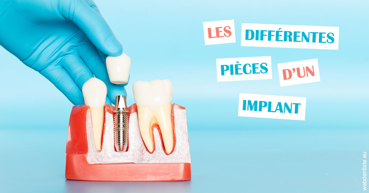 https://dr-janvier-guillemette.chirurgiens-dentistes.fr/Les différentes pièces d’un implant 2