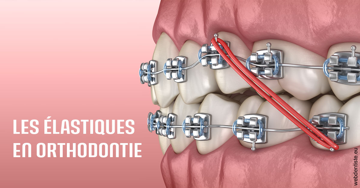 https://dr-janvier-guillemette.chirurgiens-dentistes.fr/Elastiques orthodontie 2