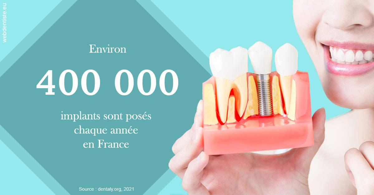 https://dr-janvier-guillemette.chirurgiens-dentistes.fr/Pose d'implants en France 2
